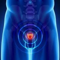 Mejoran tratamientos contra el cáncer de próstata
