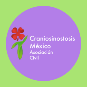 Craniosinostosis México