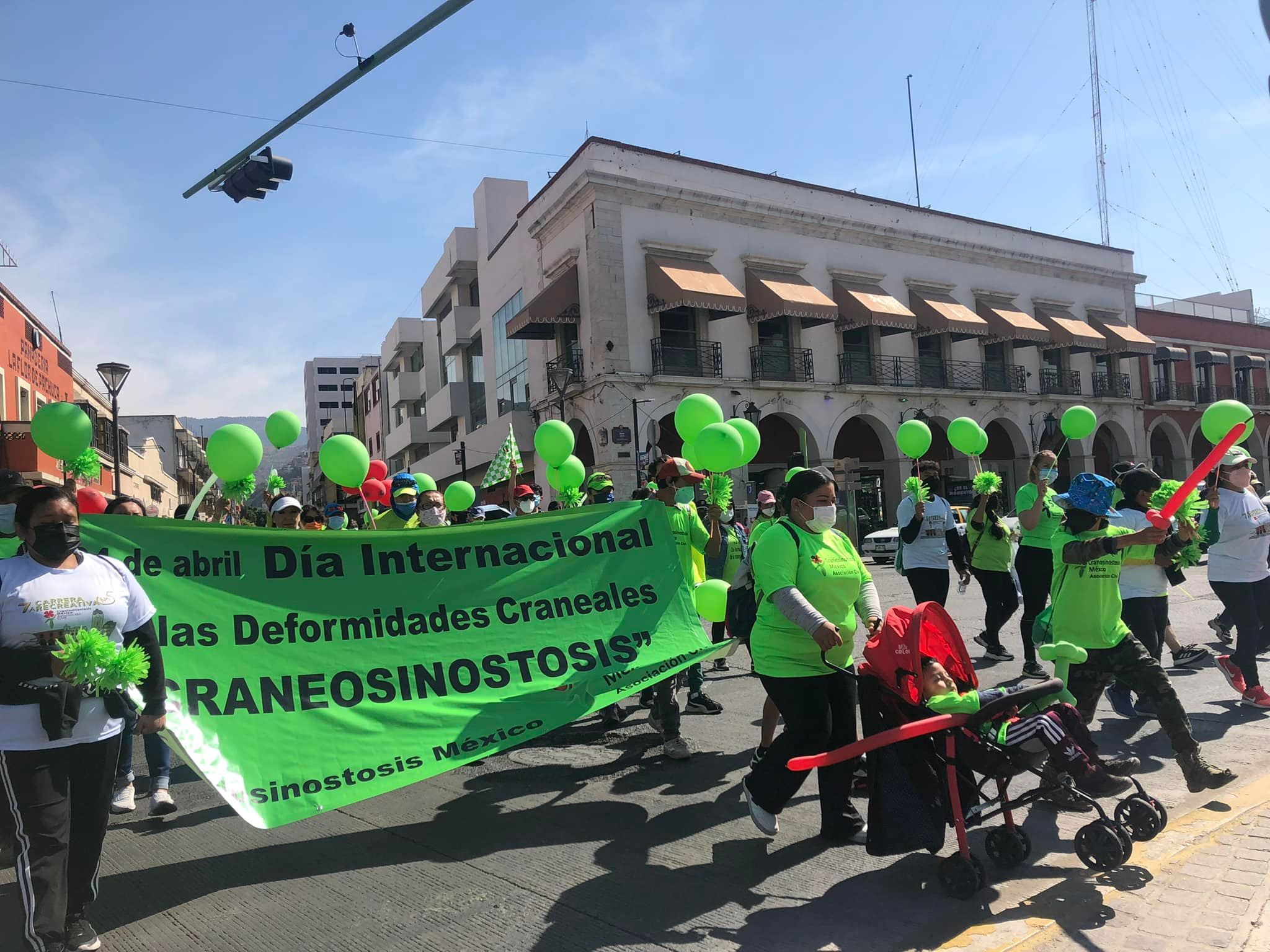 Conmemoran el Día de la Craneosinostosis