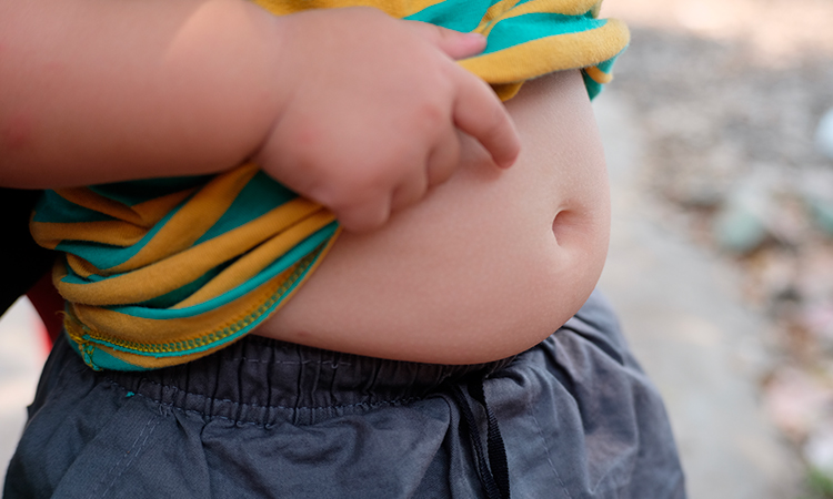 La obesidad infantil es uno de los problemas de salud pública más importantes en México.